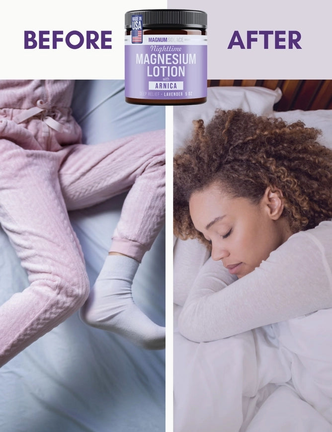 Magnum Solace Magnesium Lotion – Nighttime Magnesium Cream – Apply to Leg Muscles, Arms or Chest - Topical Magnesium Chloride – USA Made 5 oz.